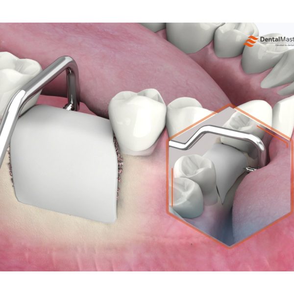 Hook-Type Bone Tack Holder - Image 3